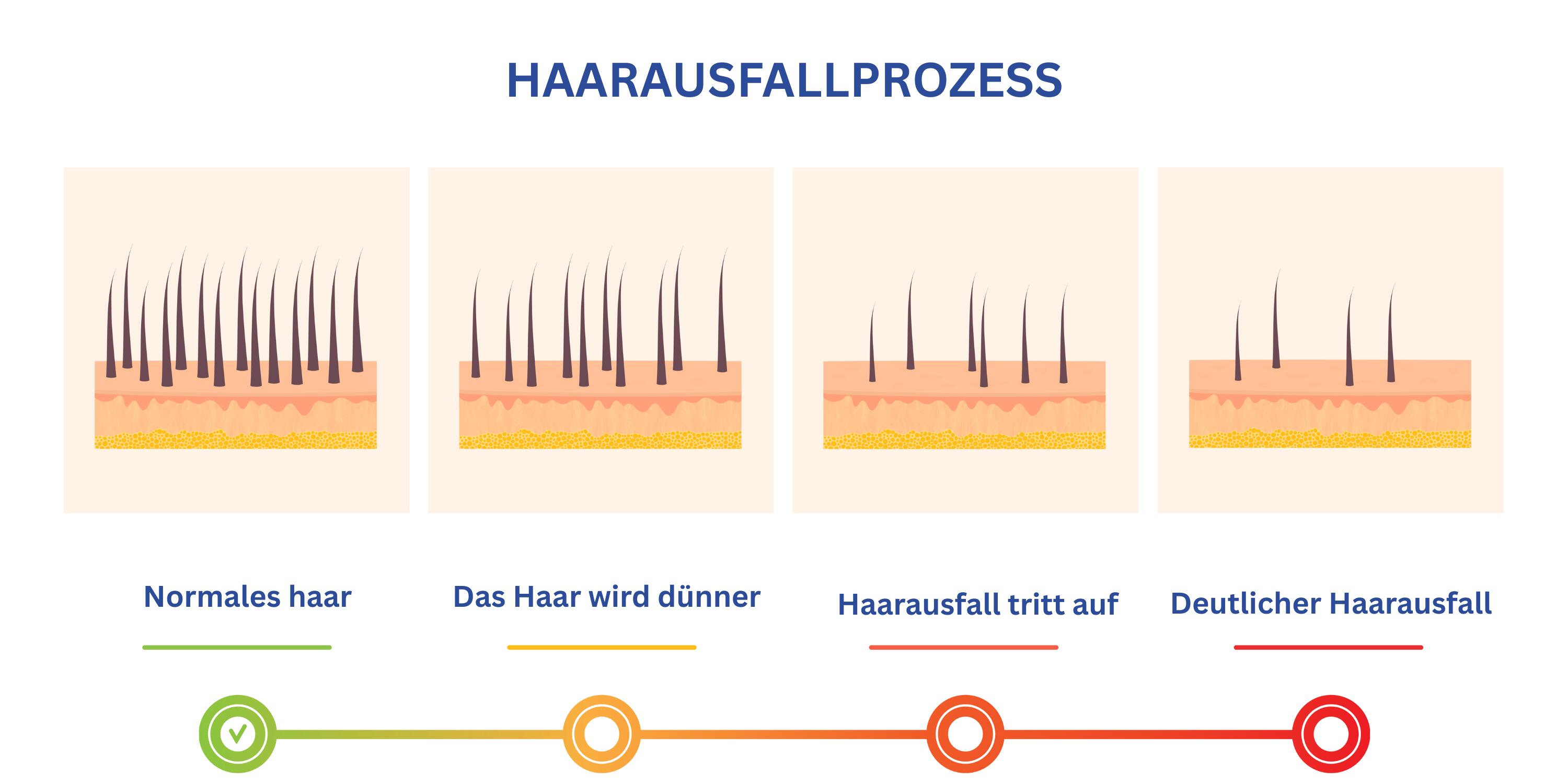 Eine Infografik zeigt die verschiedenen Stadien von Haarausfall, von normal dichtem Haar bis zu deutlich sichtbaren kahlen Stellen.